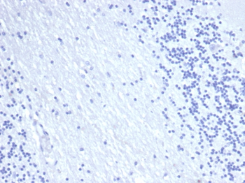 EPCAM Antibody