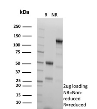 SCGB2A2 Antibody