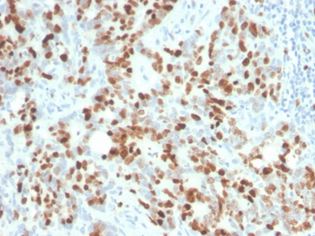 MKI67 Antibody