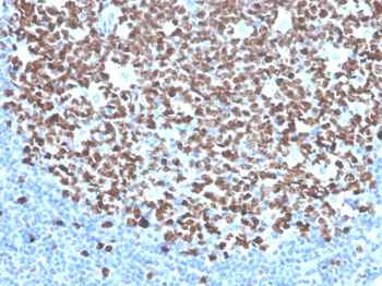 MKI67 Antibody