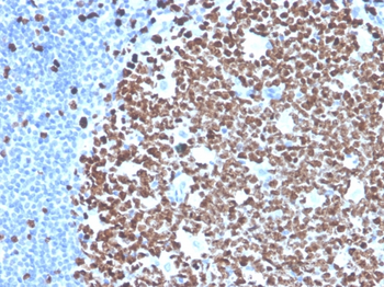 MKI67 Antibody