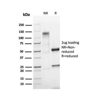 MKI67 Antibody