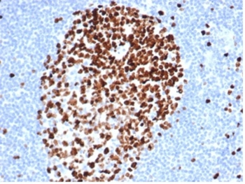 MKI67 Antibody