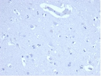 MKI67 Antibody