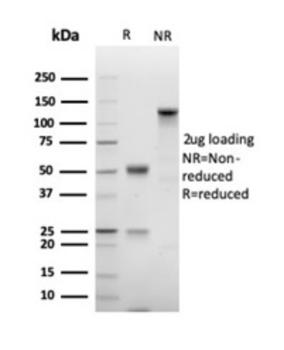 MKI67 Antibody