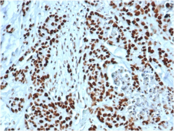 MSH2 Antibody
