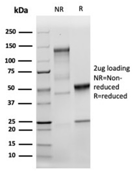 MSH2 Antibody