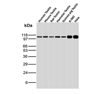 MSH2 Antibody