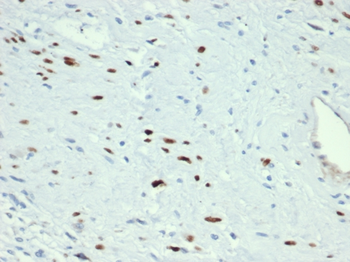 MYOD1 Antibody