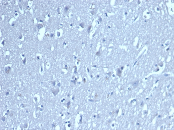 LEF1 Antibody
