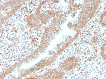 PMS2 Antibody