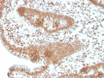 PMS2 Antibody