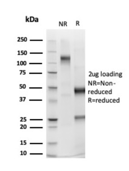 PMS2 Antibody