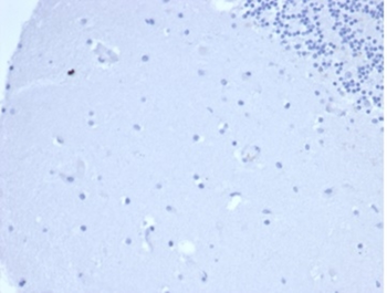 PRL Antibody