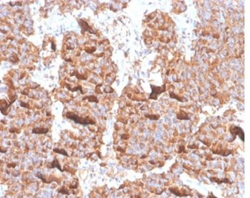 PRL Antibody