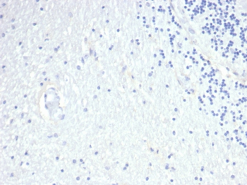 PRL Antibody