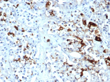 PRL Antibody