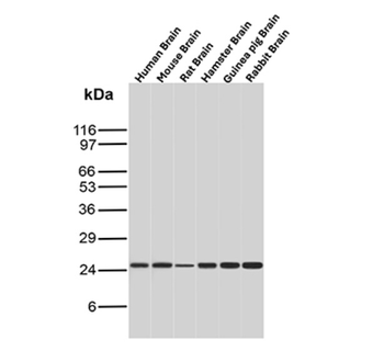 PRL Antibody
