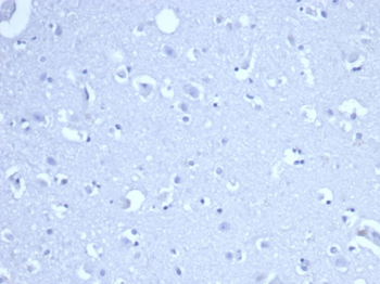 RRM1 Antibody