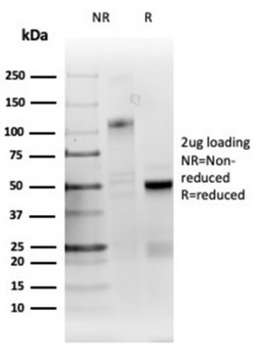 RRM1 Antibody