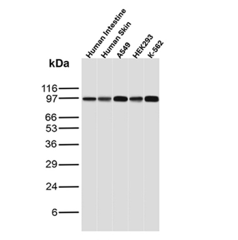 RRM1 Antibody