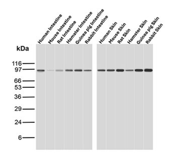 RRM1 Antibody