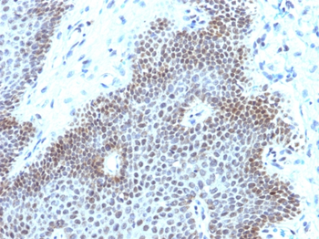 SOX11 Antibody