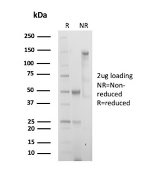 SOX11 Antibody