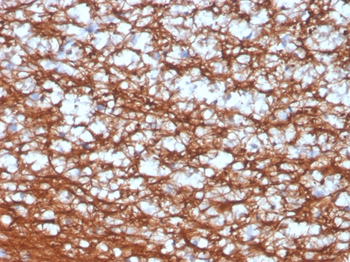 UCHL1 Antibody