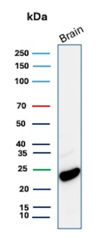 UCHL1 Antibody