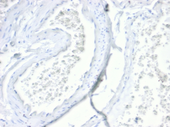 VIL1 Antibody