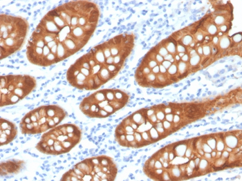 VIL1 Antibody