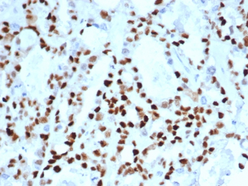 CCNE1 Antibody