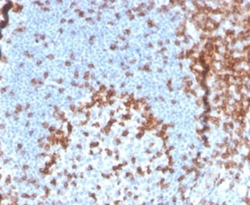 CD2 Antibody