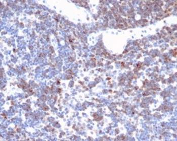 CD2 Antibody