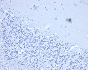 CD2 Antibody