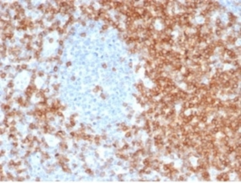 CD5 Antibody