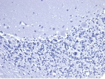 CD5 Antibody