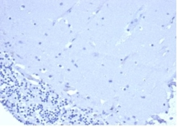 CD5 Antibody