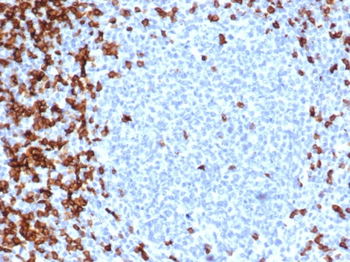 CD7 Antibody