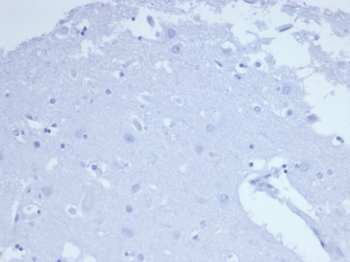 CD7 Antibody