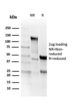 CD8A Antibody