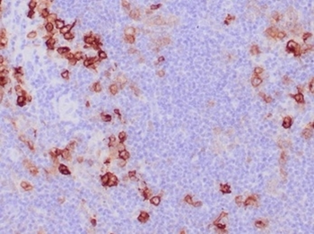 TNFRSF8 Antibody
