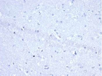 TNFRSF8 Antibody