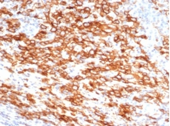 TNFRSF8 Antibody