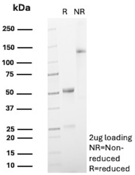 TNFRSF8 Antibody