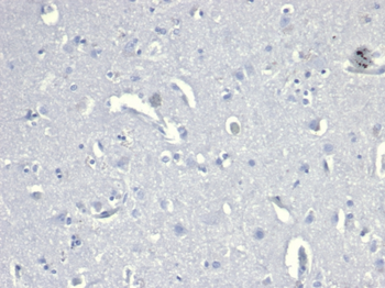 CD38 Antibody
