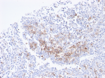 CD38 Antibody