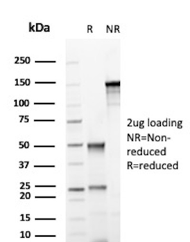 CD38 Antibody