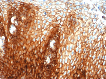 CD44 Antibody